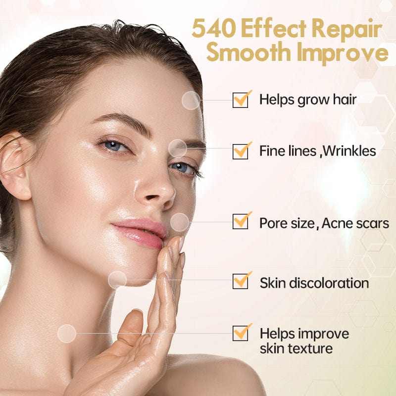 Derma Roller 540 XYZDreams