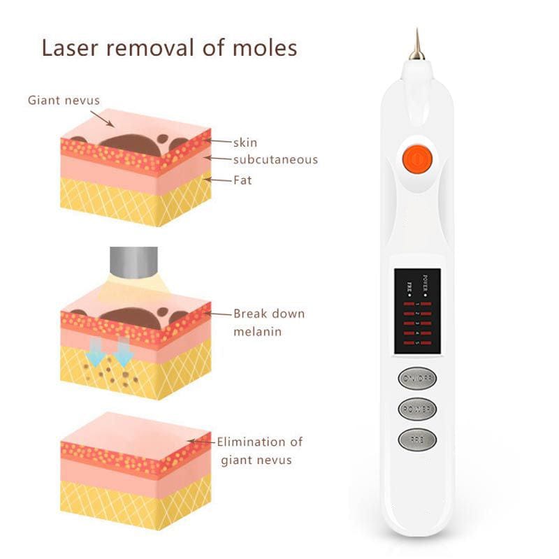 Fibroblast Plasma Pen XYZDreams