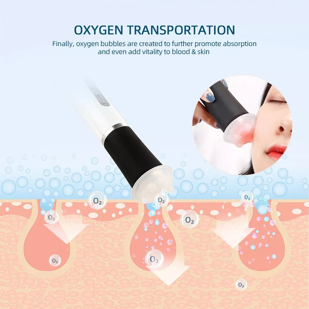 Oxygen Bubble Handle Accessory XYZDreams