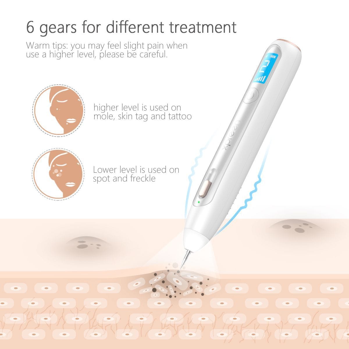 Wart Skin Tag Freckle Dark Spots Removing Pen Tool XYZDreams