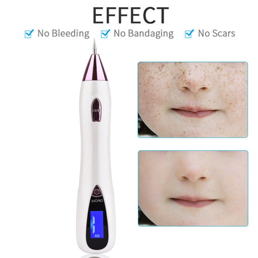 Laser Plasma Pen XYZDreams