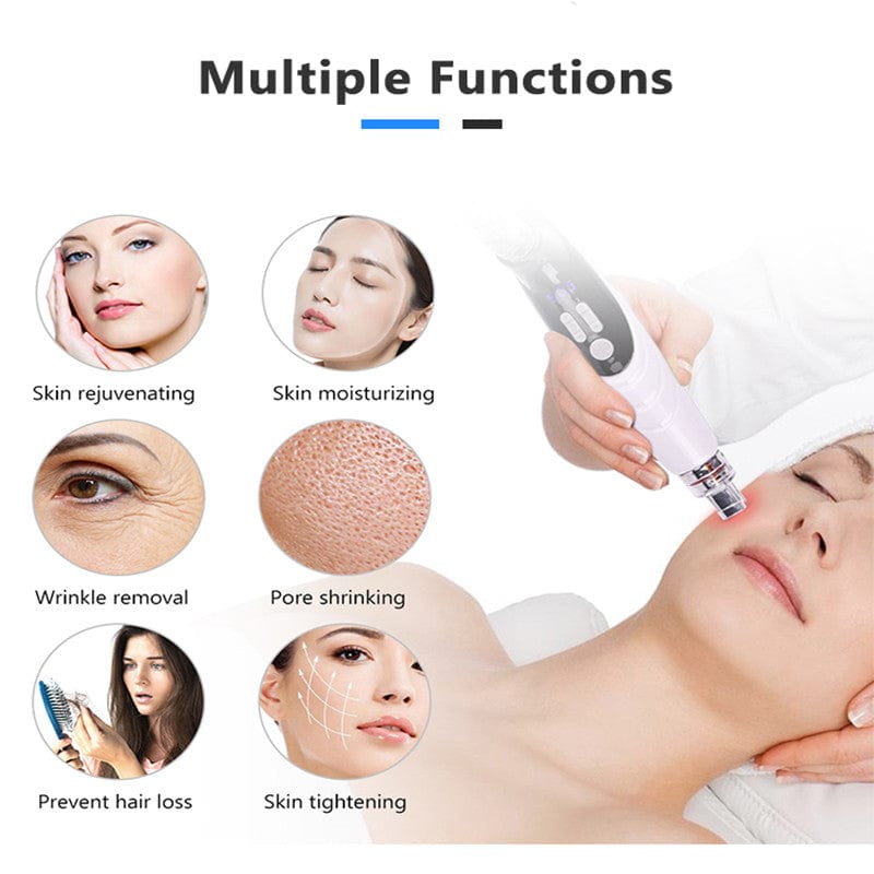 Microneedle RF Mesotherapy Gun XYZDreams